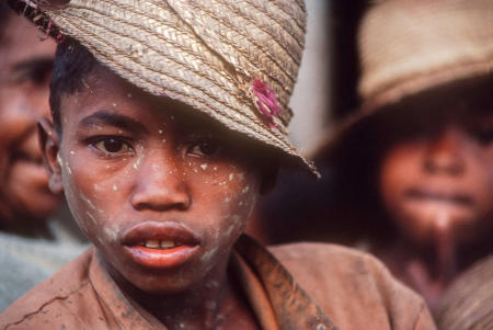 A Betsileo youth fresh from the rice paddies, has dried mud speckles on his face in remote Ambozatany.